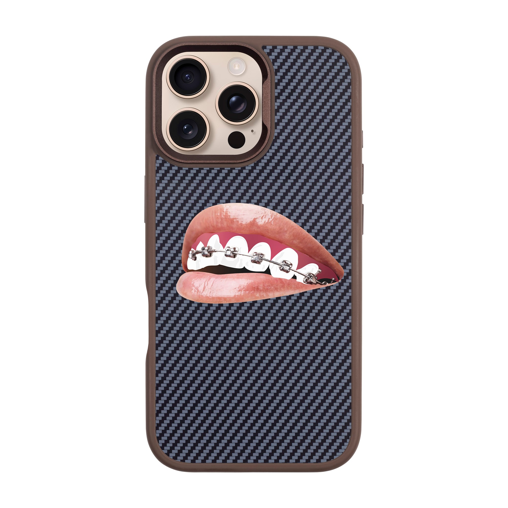 ORTHODONTIST-iPhone Plaid Kılıf MagSafe Özellikli