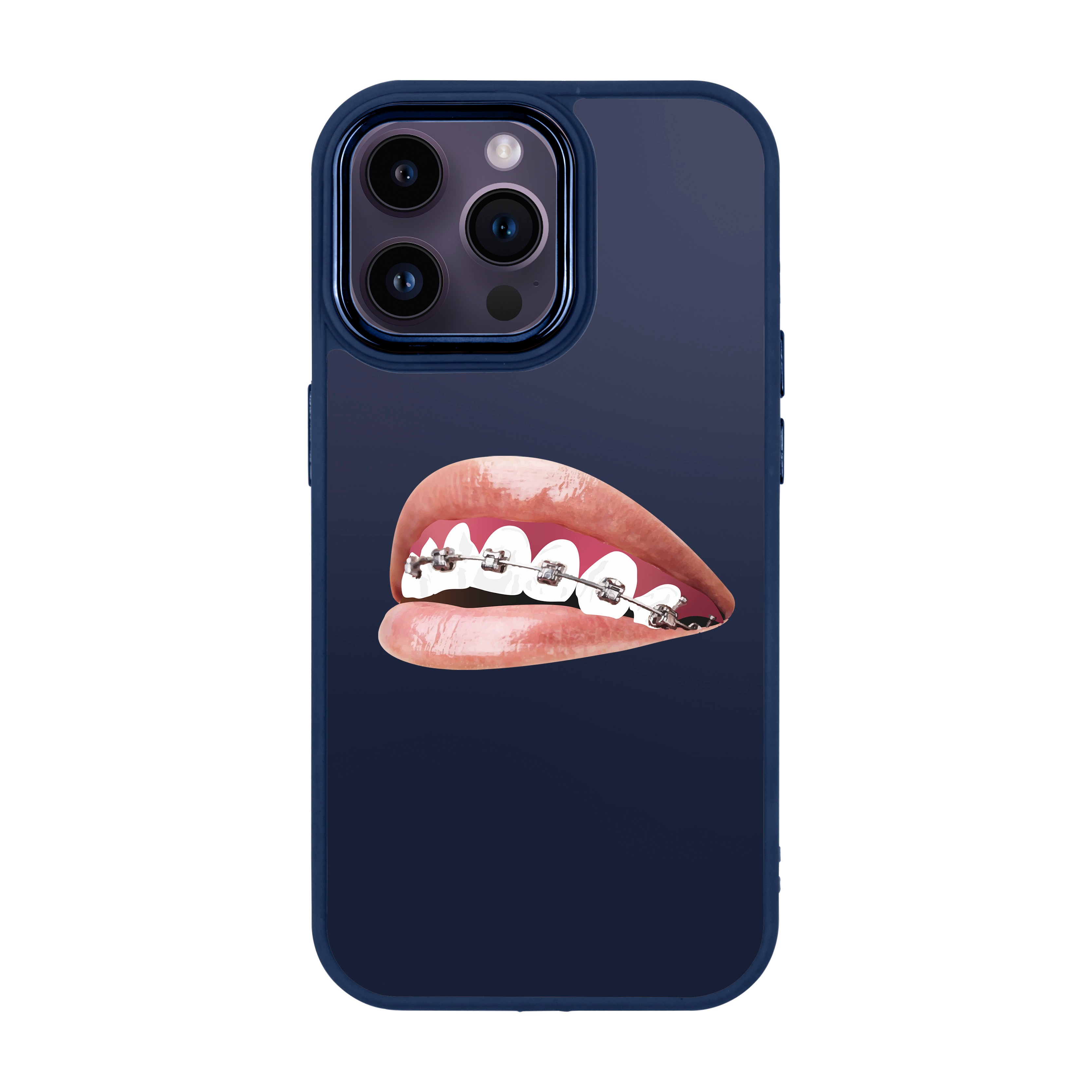 ORTHODONTIST - iPhone Proof Case