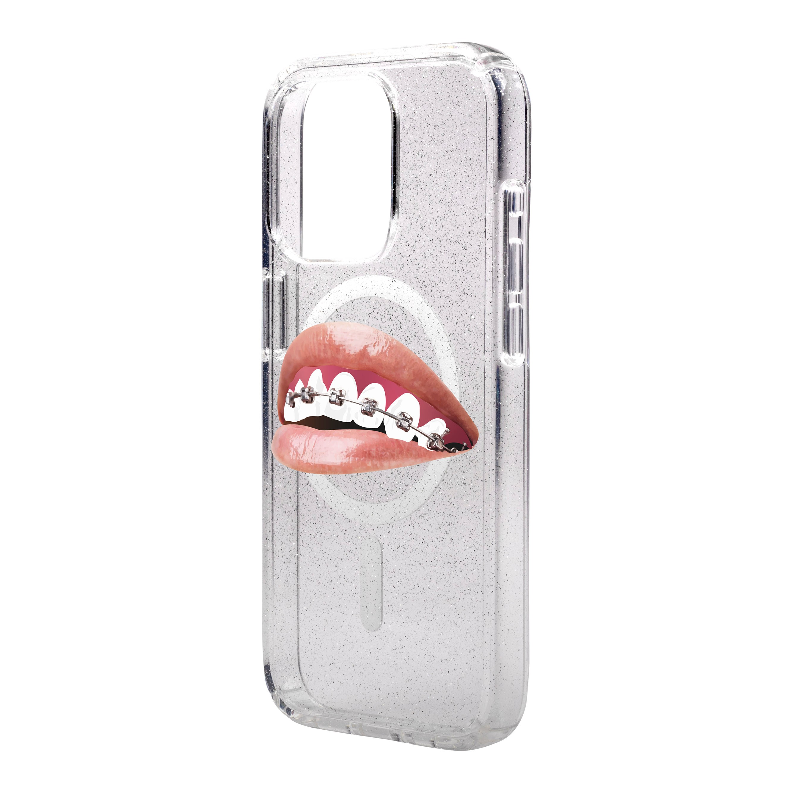 ORTHODONTIST-iPhone Shiny Case with MagSafe