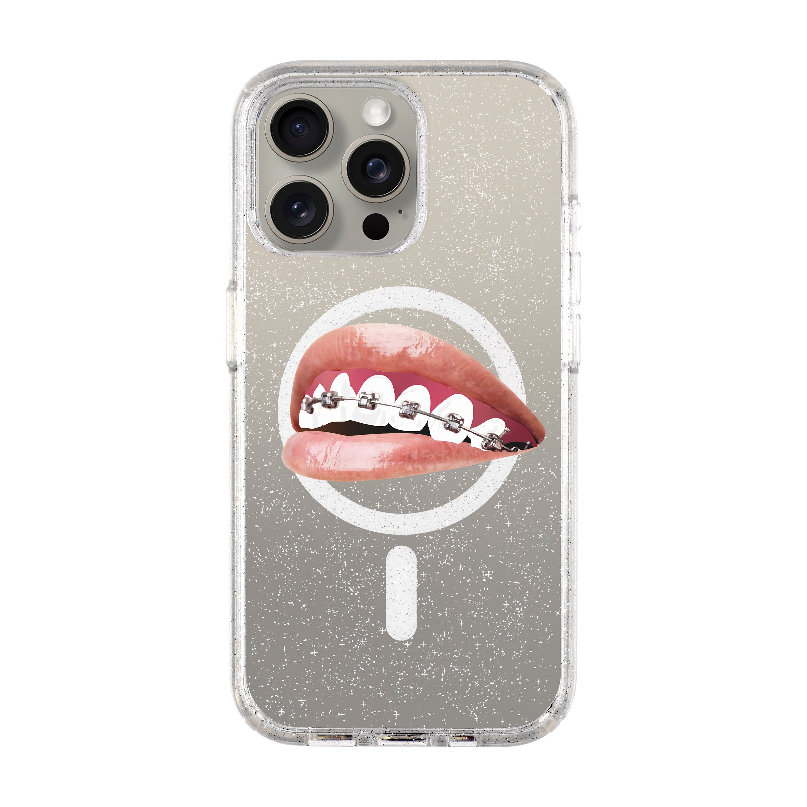 ORTHODONTIST-iPhone Shiny Case with MagSafe