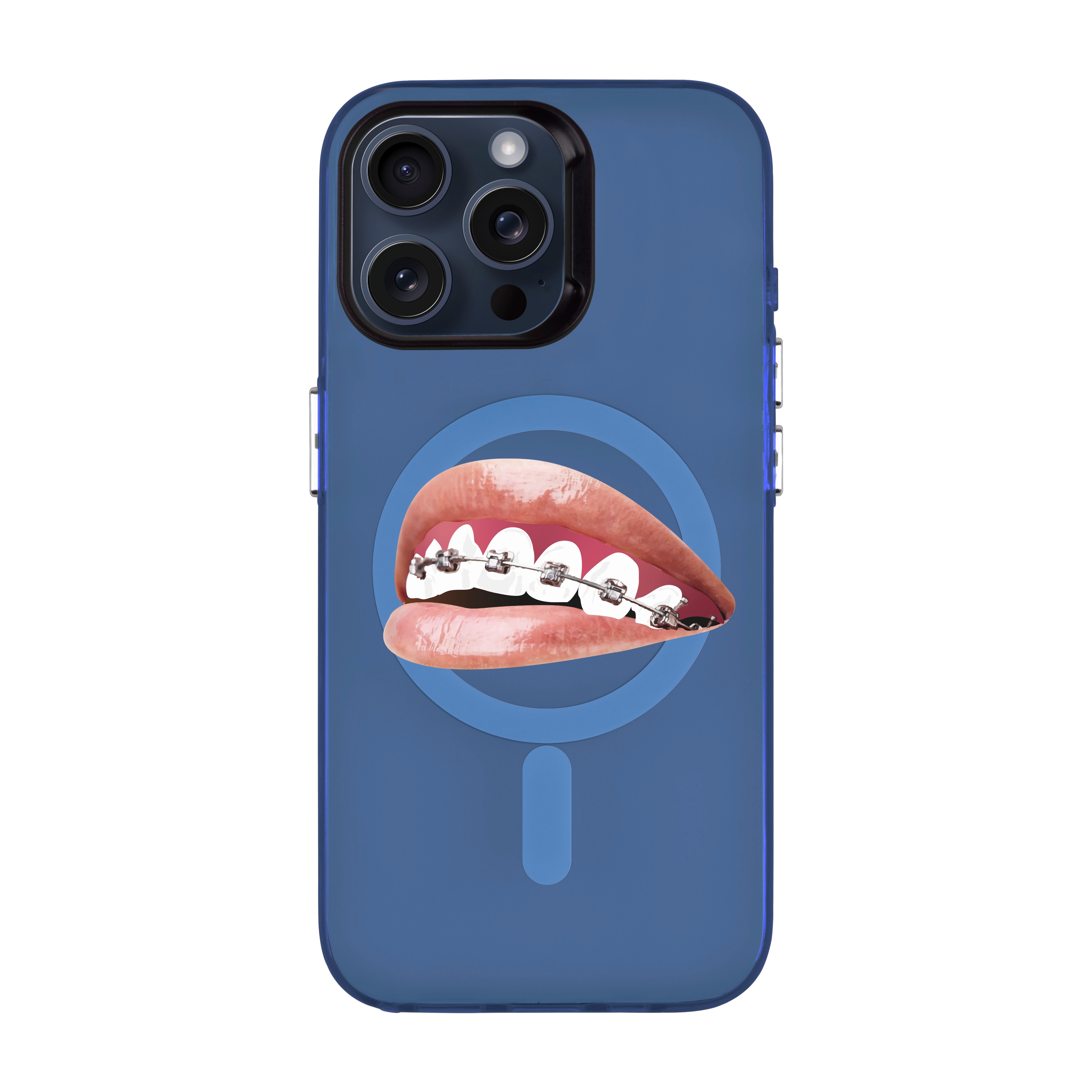 ORTHODONTIST-iPhone Hold Kılıf MagSafe Özellikli