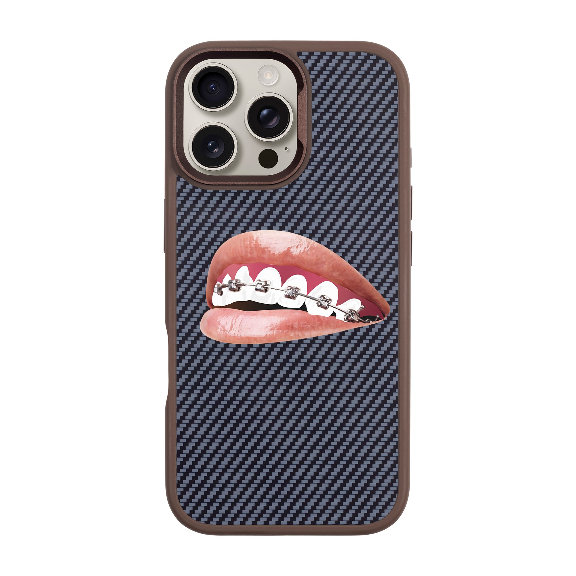 ORTHODONTIST-iPhone Plaid Kılıf MagSafe Özellikli