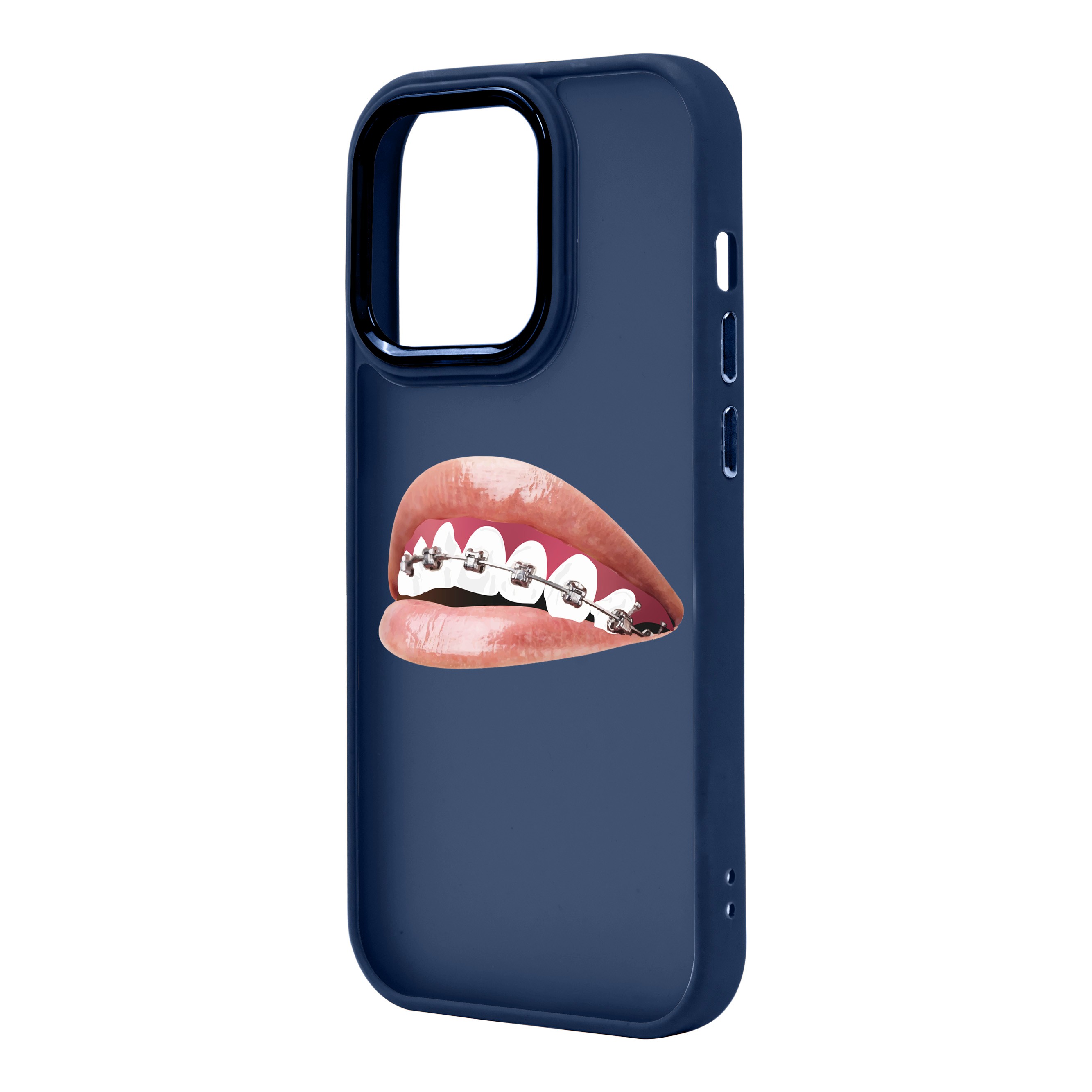 ORTHODONTIST - iPhone Proof Case