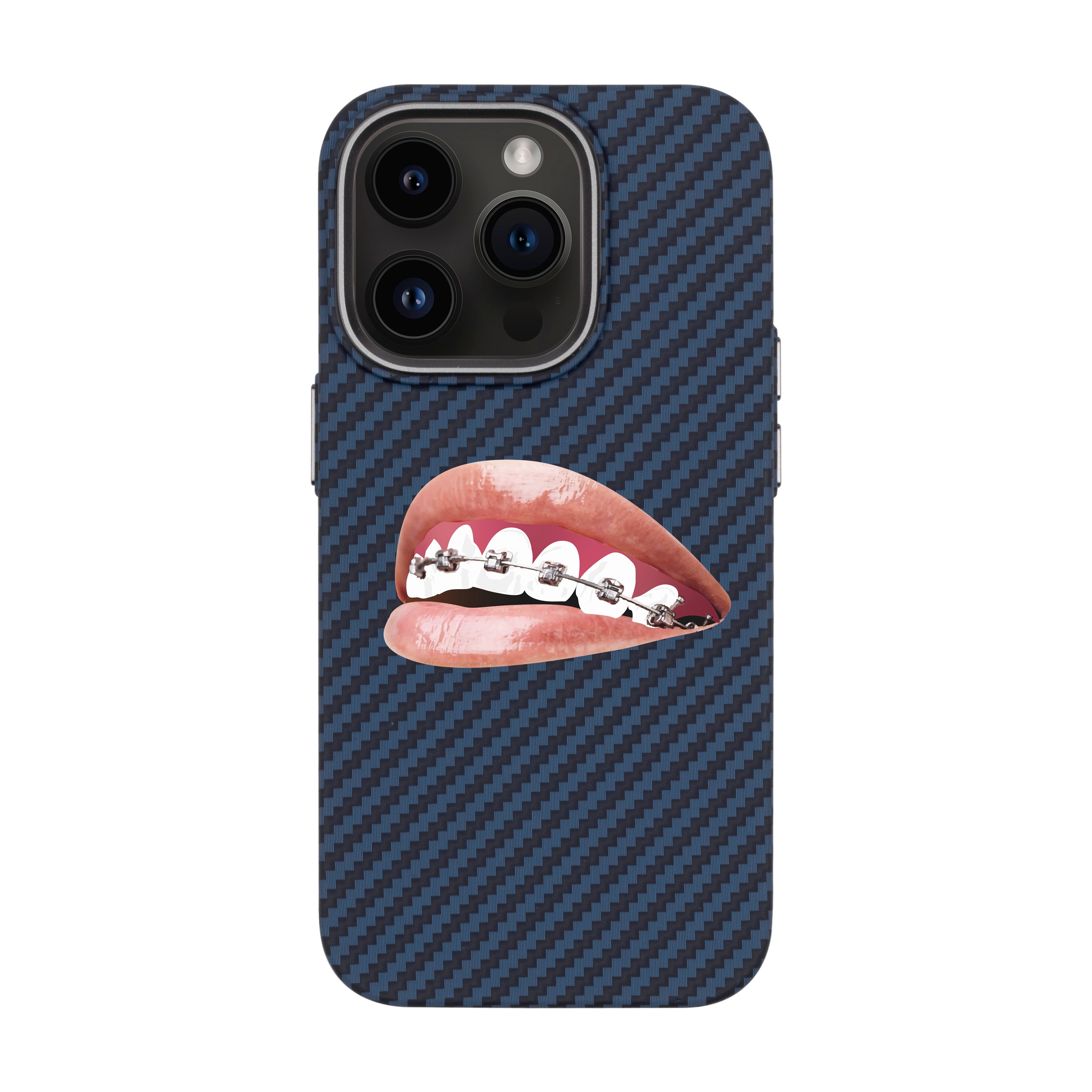 ORTHODONTIST-iPhone Carbon Kılıf MagSafe Özellikli