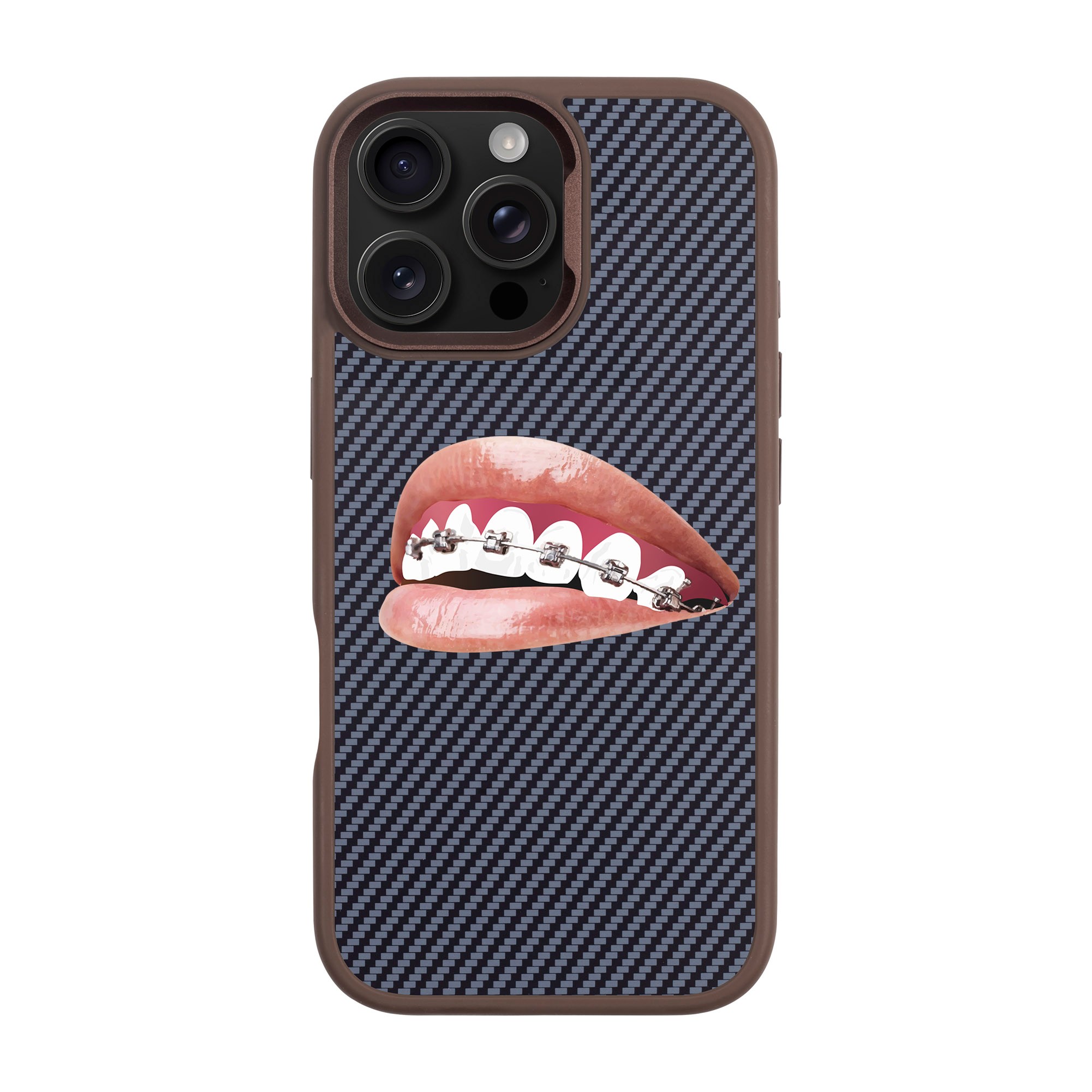 ORTHODONTIST-iPhone Plaid Kılıf MagSafe Özellikli