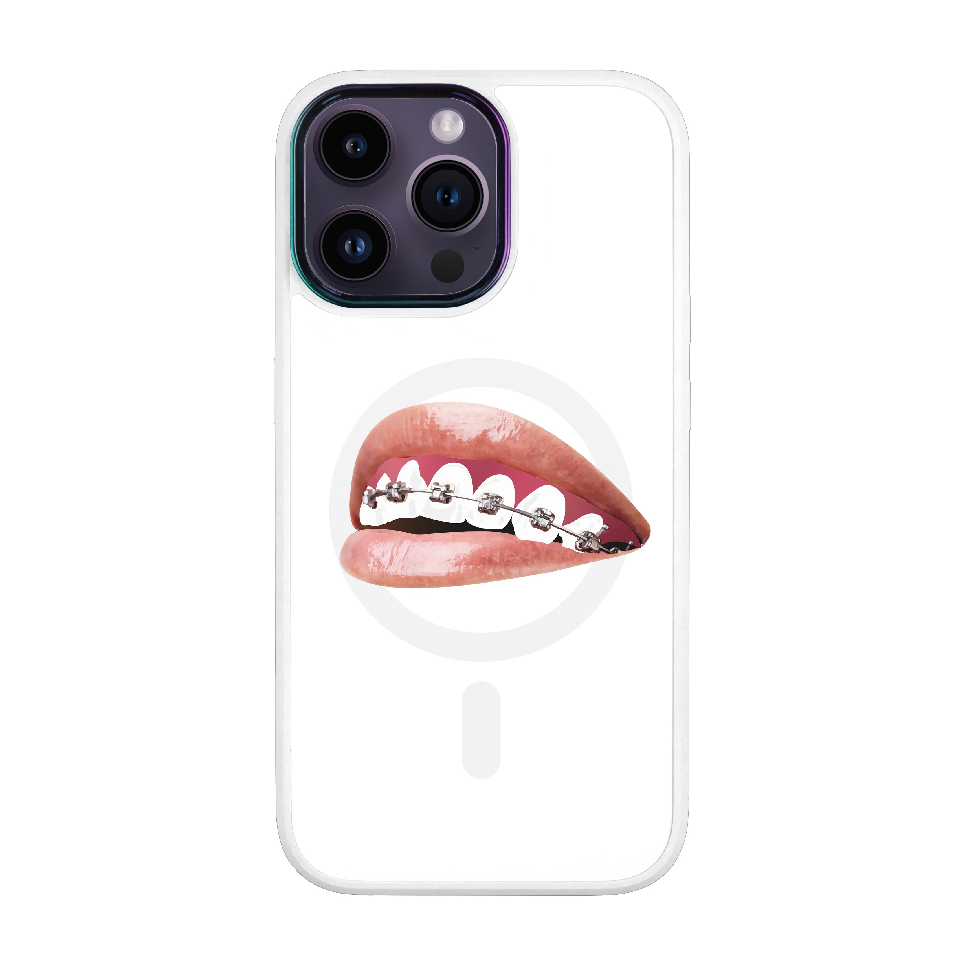 ORTHODONTİST - iPhone Vigor Case with Magsafe