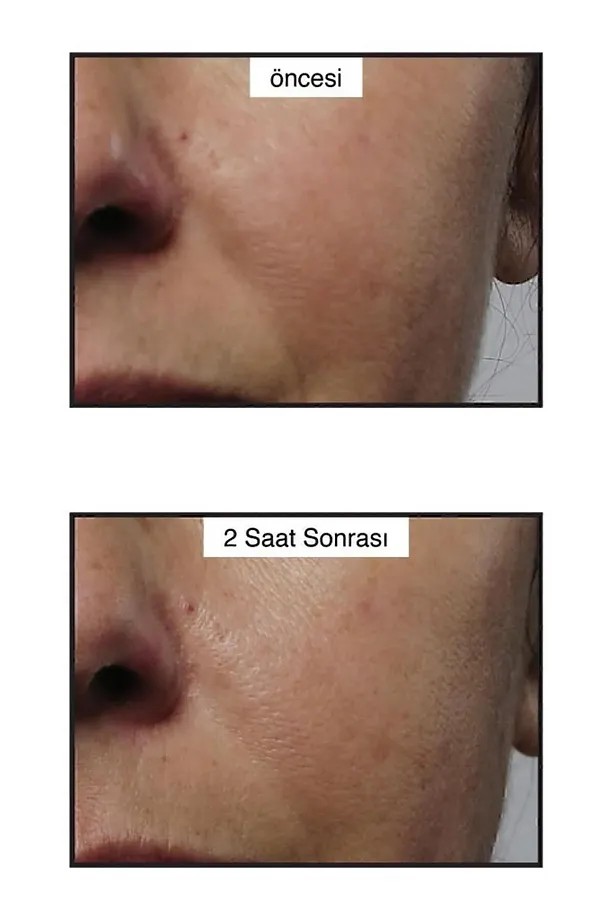 Murad Rapid Collagen Infusion – Anında Sıkılaştırıcı Kolajen Serumu 30 ml
