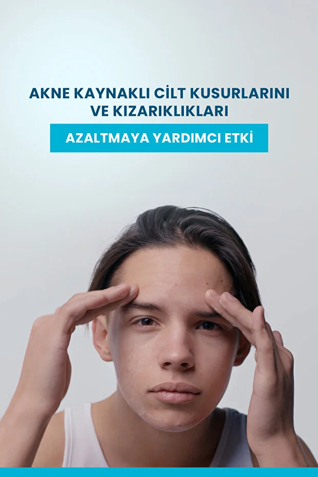 Ducray Keracnyl PP+ Akneye Eğilimli Ciltler İçin Bakım Kremi 30 ml