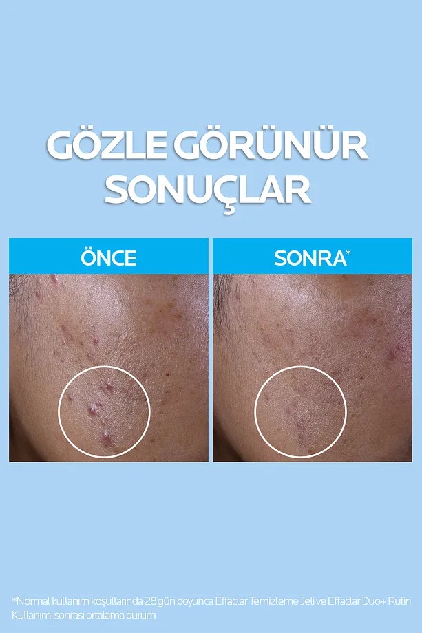 La Roche Posay Effaclar Temizleme Jeli Yağlı ve Akneye Eğilim Gösteren Ciltler 400 ml