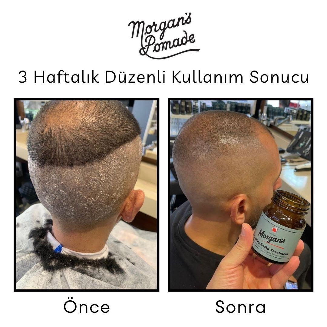 Morgan's Pomade Cooling Scalp Treatment - Egzama Kepek Karşıtı Baş Derisi Bakım Tedavisi 100 gr