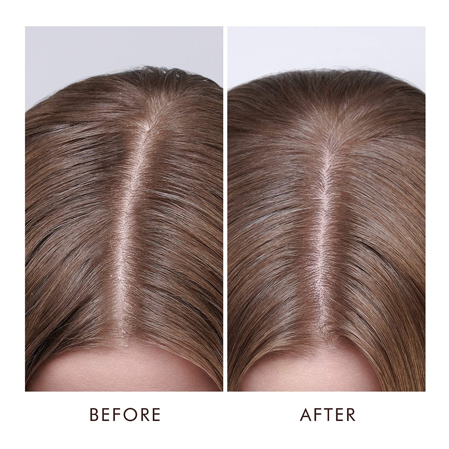 MOROCCANOIL Dry Scalp Treatment 45 Ml