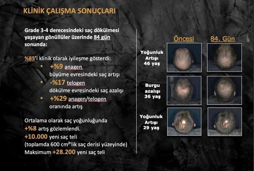 Hair Growth Volume Serum - Dökülme Karşıtı Yenileyici Serum 50 ml