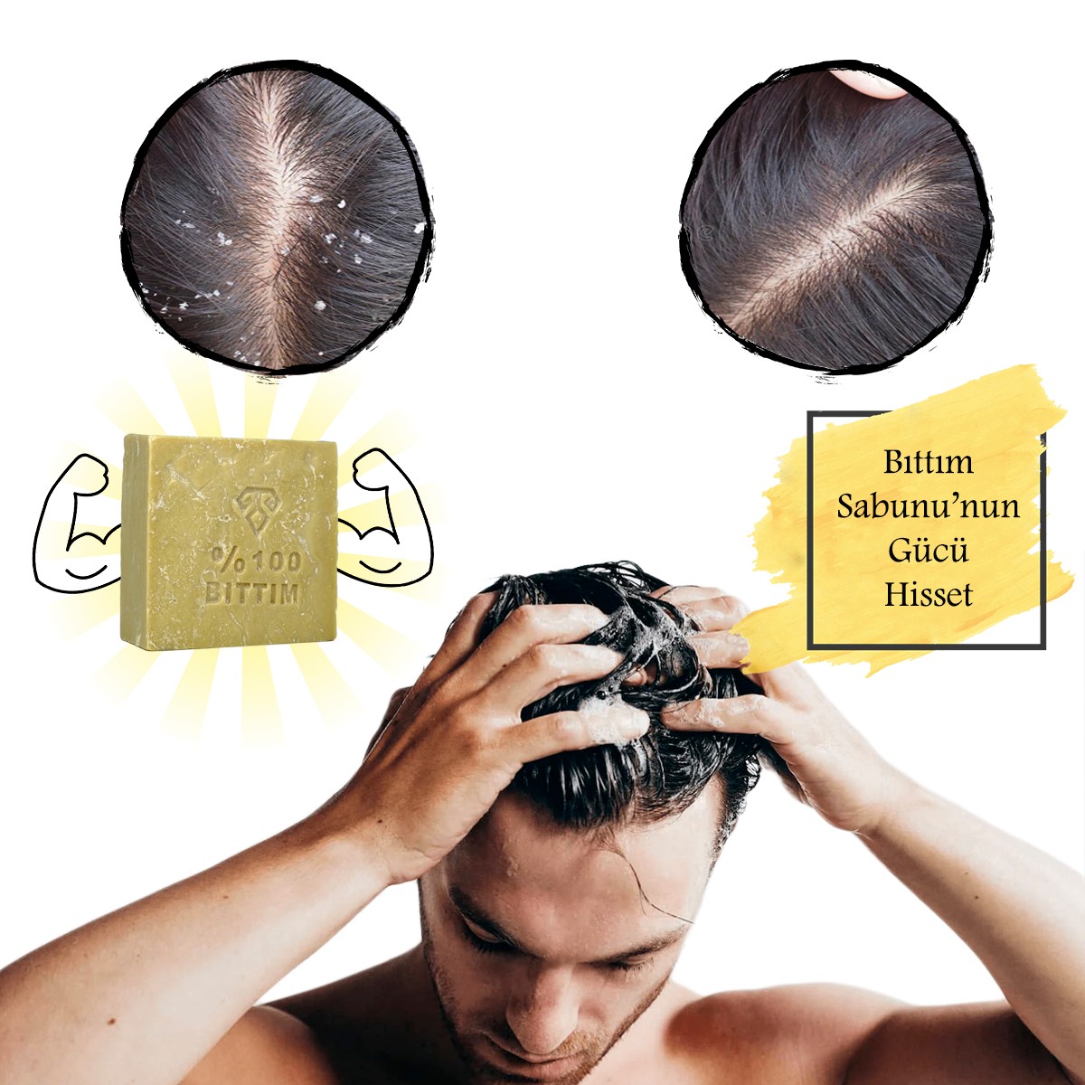 Antioch %100 Bıttım Sabunu Saç Dökülmesi, Yıpranmış, Kepekli Ve Yağlı Saçlar İçin En Doğru Seçimdir.