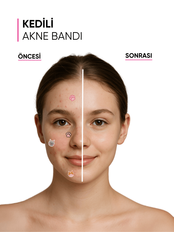 mia klinika Cat-Shaped Acne Patch - 20 Pieces