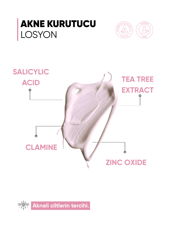Sivilce, Karşıtı Kurutucu Losyon
