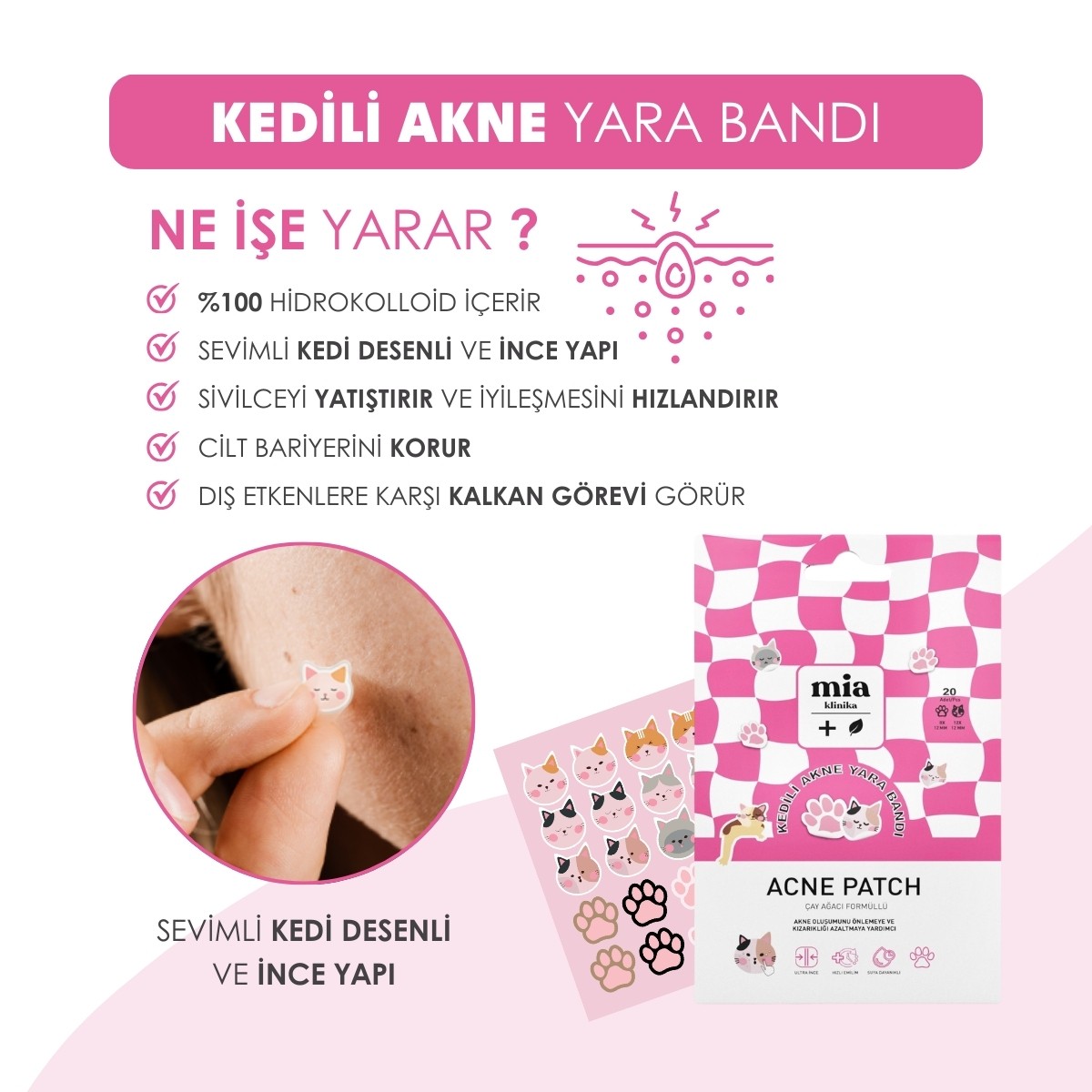 Mia Klinika Kedili Akne Yara Bandı – 20 Adet