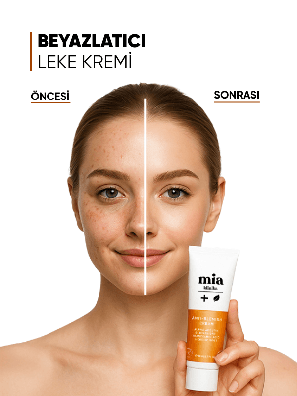 mia klinika Cilt Beyazlatıcı, Ton Eşitlemeye Yardımcı Leke Kremi