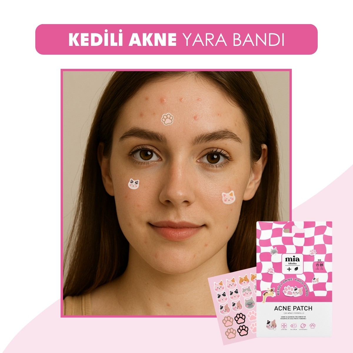 Mia Klinika Kedili Akne Yara Bandı – 20 Adet