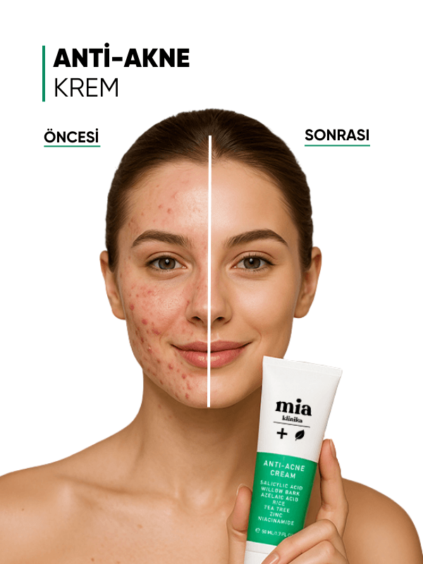 mia klinika Sivilce ve Akne Karşıtı Bariyer Güçlendirici Nemlendirici Krem