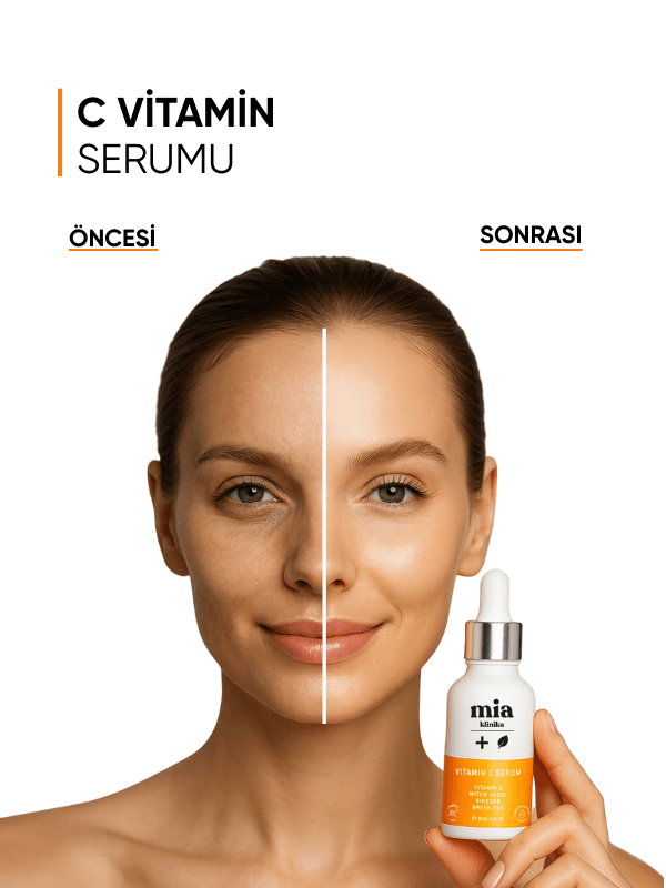 mia klinika Gözenek ve Siyah Nokta Gidermeye Yardımcı Aydınlatıcı C Vitamini Serumu