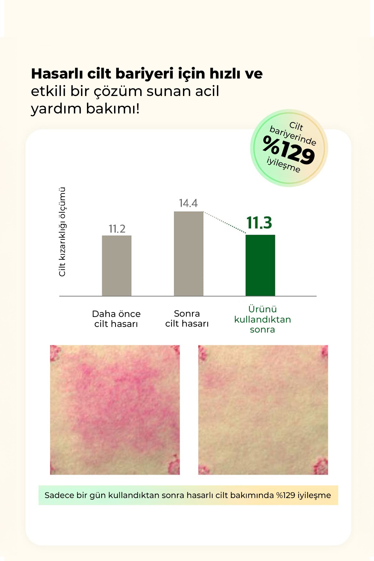 HAMEL Saf Nemlendirici Yatıştırıcı Mist Kore Serum 100ml – Cilt Bariyeri Güçlendirici & Hipoalerjenik Bakım