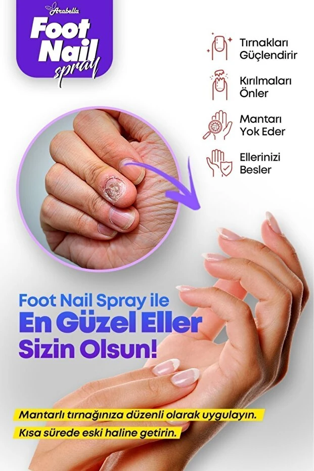 Ayak ve Tırnak Mantarı Karşıtı Bakım Spreyi 50 ml - Koku Önleyici