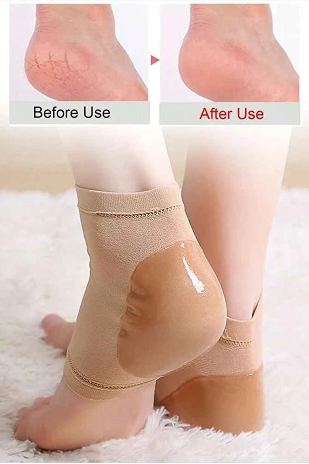 Silikon Nemlendirici Topuk Çorabı Çatlak Nasır İçin Nemlendirici Çorap Topuk Çatlaklarına Son!