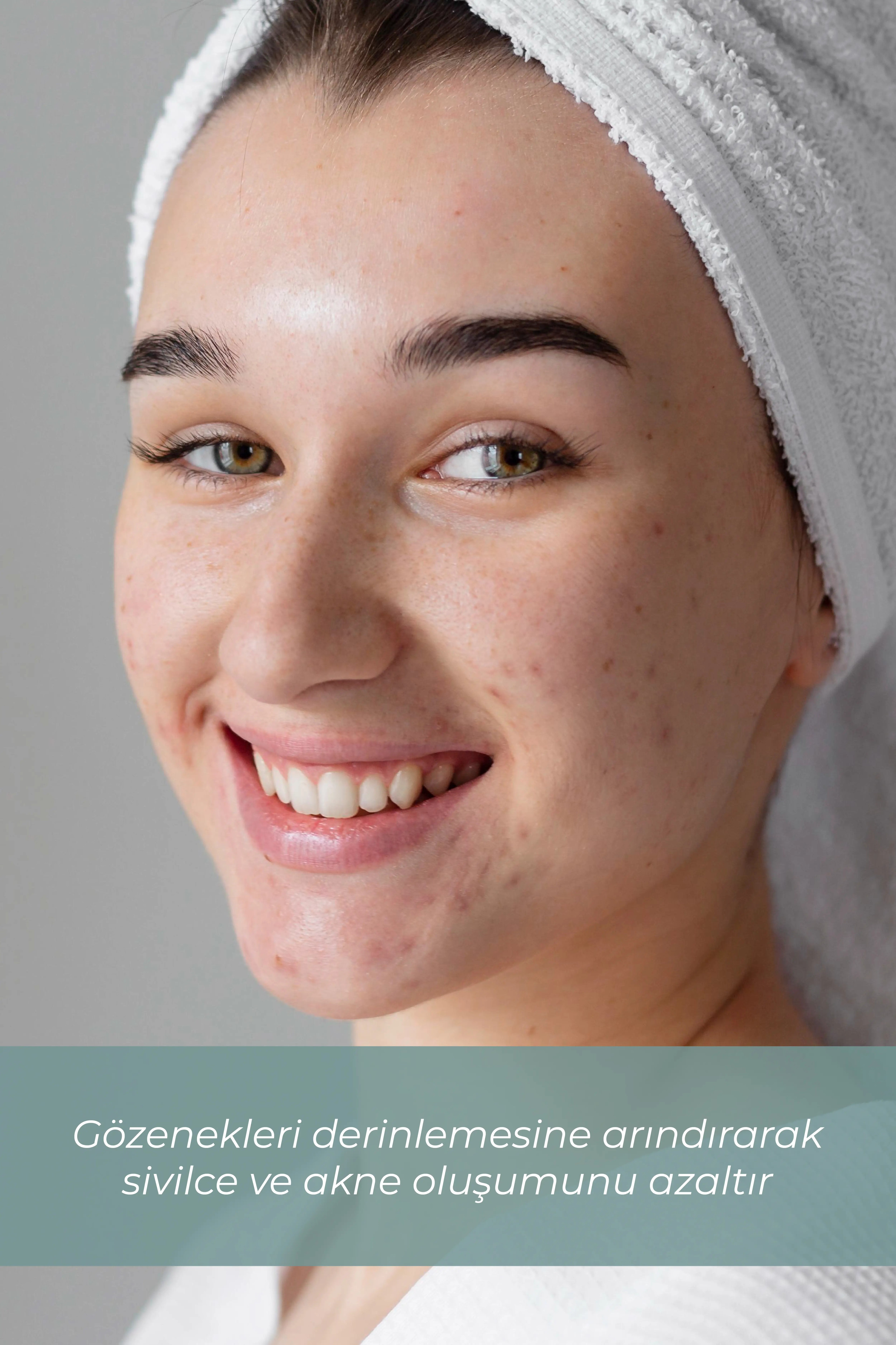 Akne Karşıtı Serum