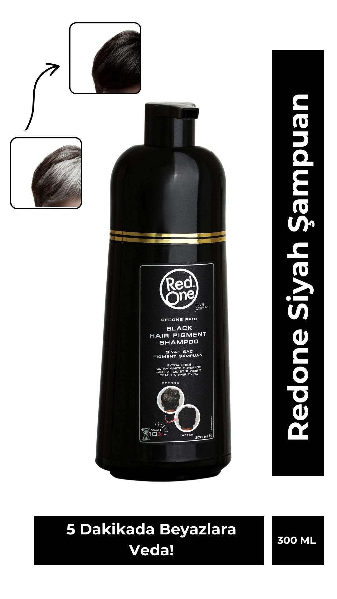 Redone Siyah Şampuan 300 ML 