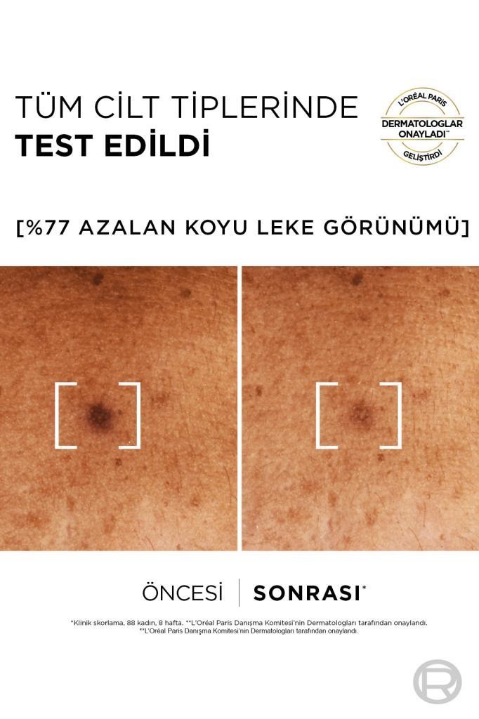 Bright Reveal Sivilce, Güneş, Yaşlanma Lekelerinde Etkili Koyu Leke Karşıtı Serum 10%Niasinamid 30ml