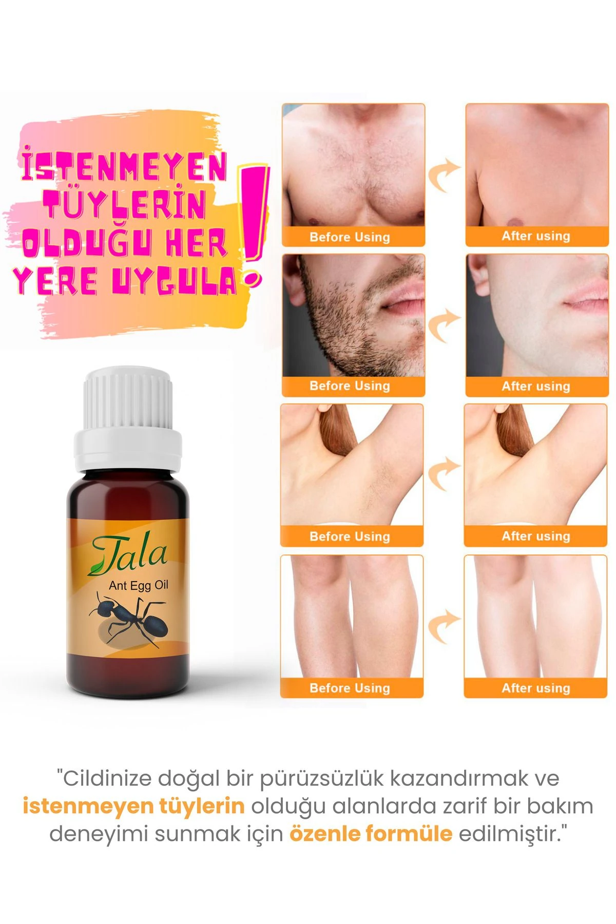 Karınca Yumurtası Yağı Tüy Azaltıcı Tüy İnceltici Tüy Dökücü 20 ML