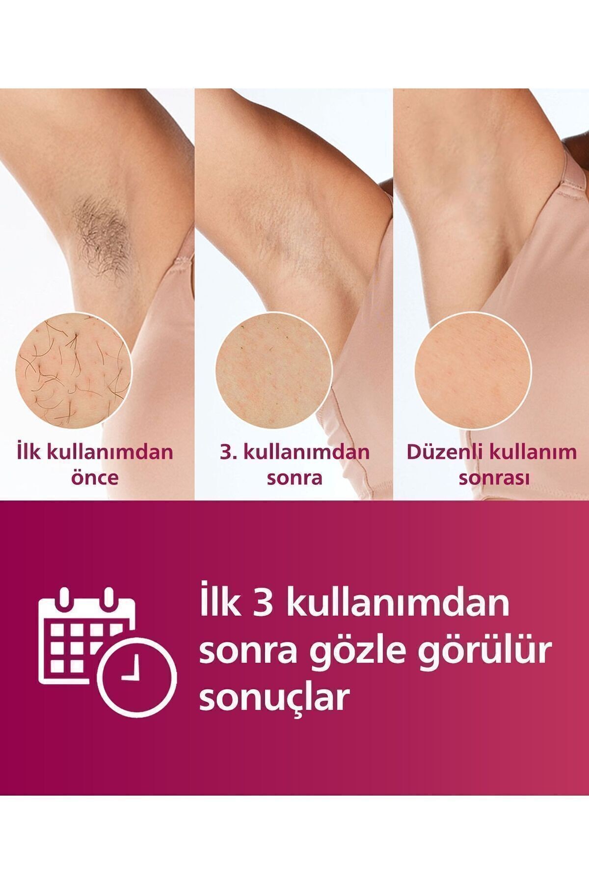Philips Lumea Advanced BRI921/00 IPL Lazer Epilasyon Aleti