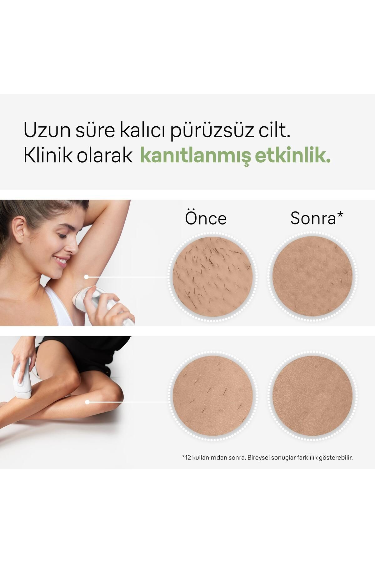 Braun Silk Expert Pro 3 PL3132 IPL Lazer Epilasyon Aleti