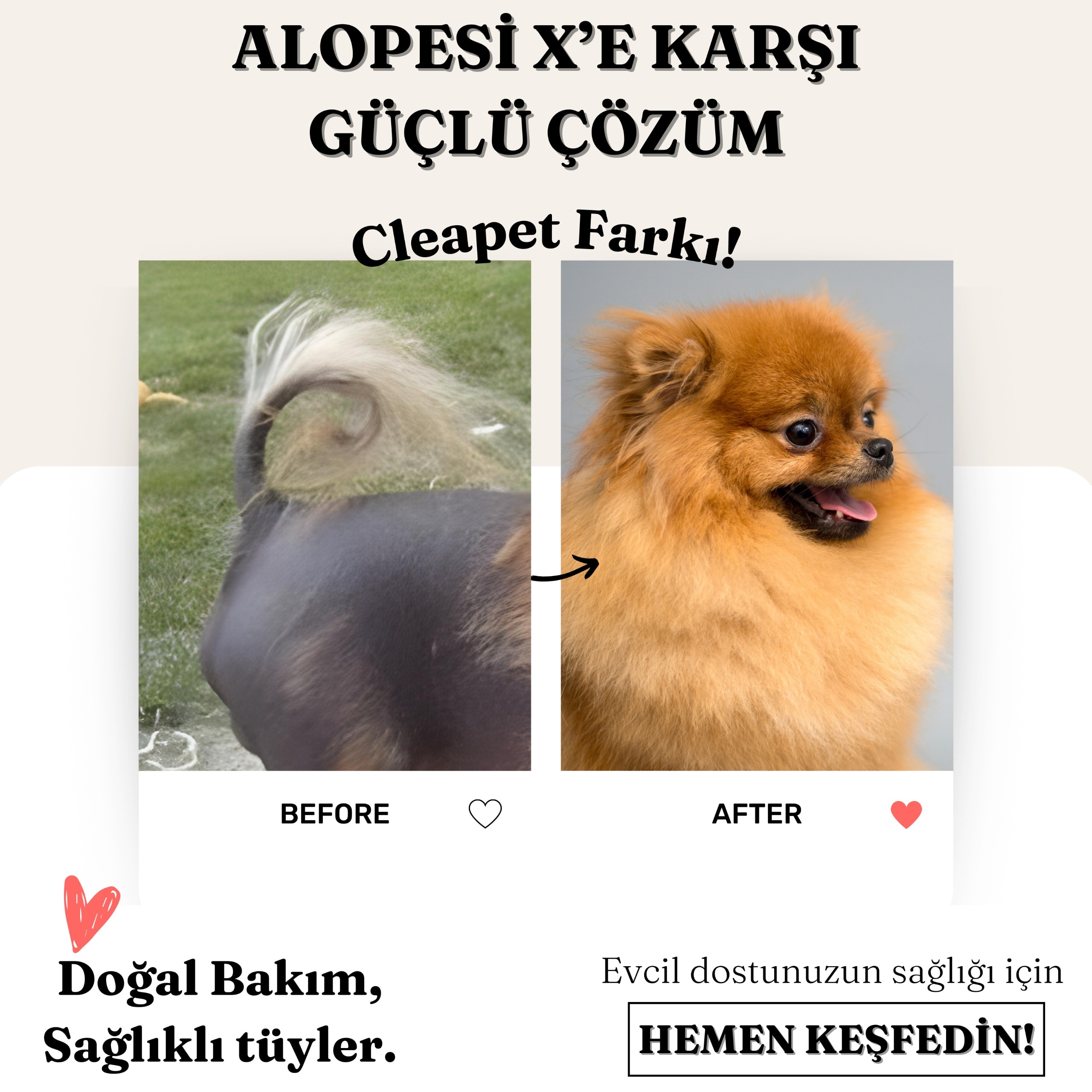 ALOPESİ X TEDAVİ SETİ