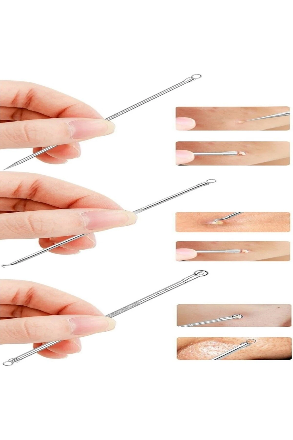 4 Parça Hijyenik Kutulu Paslanmaz Çelik Siyah Nokta Temizleme Komedon Aleti