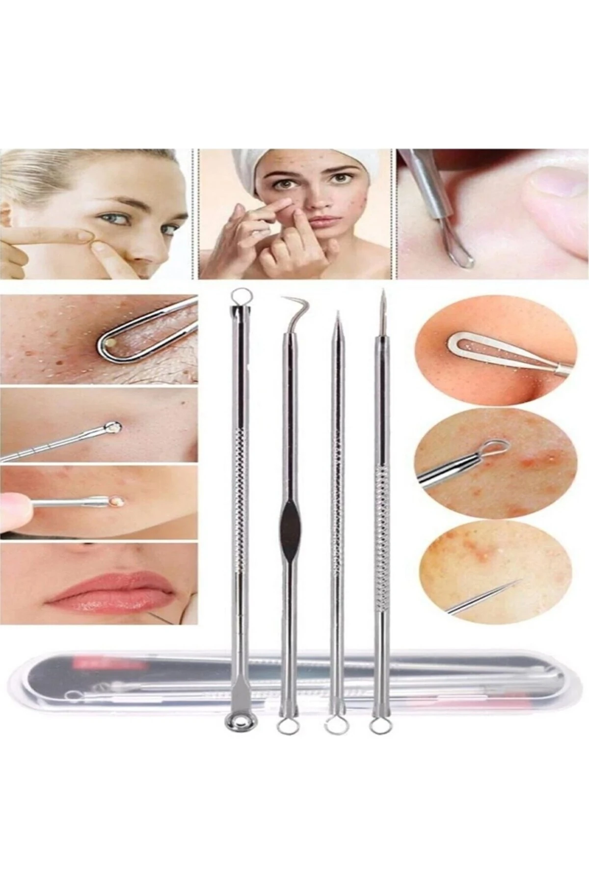 4 Parça Hijyenik Kutulu Paslanmaz Çelik Siyah Nokta Temizleme Komedon Aleti