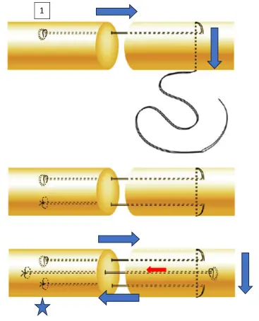 Tendon Tamirinde Sütür Teknikleri