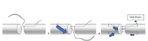 Tendon Tamirinde Sütür Teknikleri