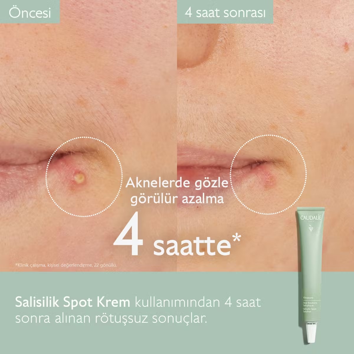 Caudalie Vinopure Akne Karşıtı Salisilik Spot Krem 15mL