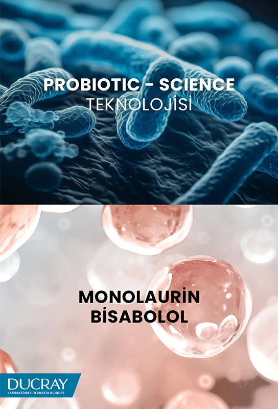 Ducray Kelual Squanorm Yağlı Şaçlar için 400 ml Kepek Şampuanı