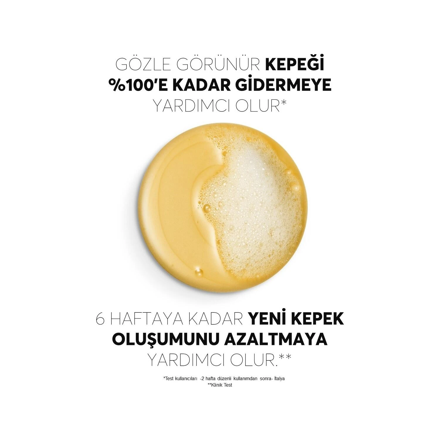 Vichy Dercos Anti-Dandruff Şampuan Kepek Karşıtı Normal ve Yağlı Saçlar İçin 390 ml