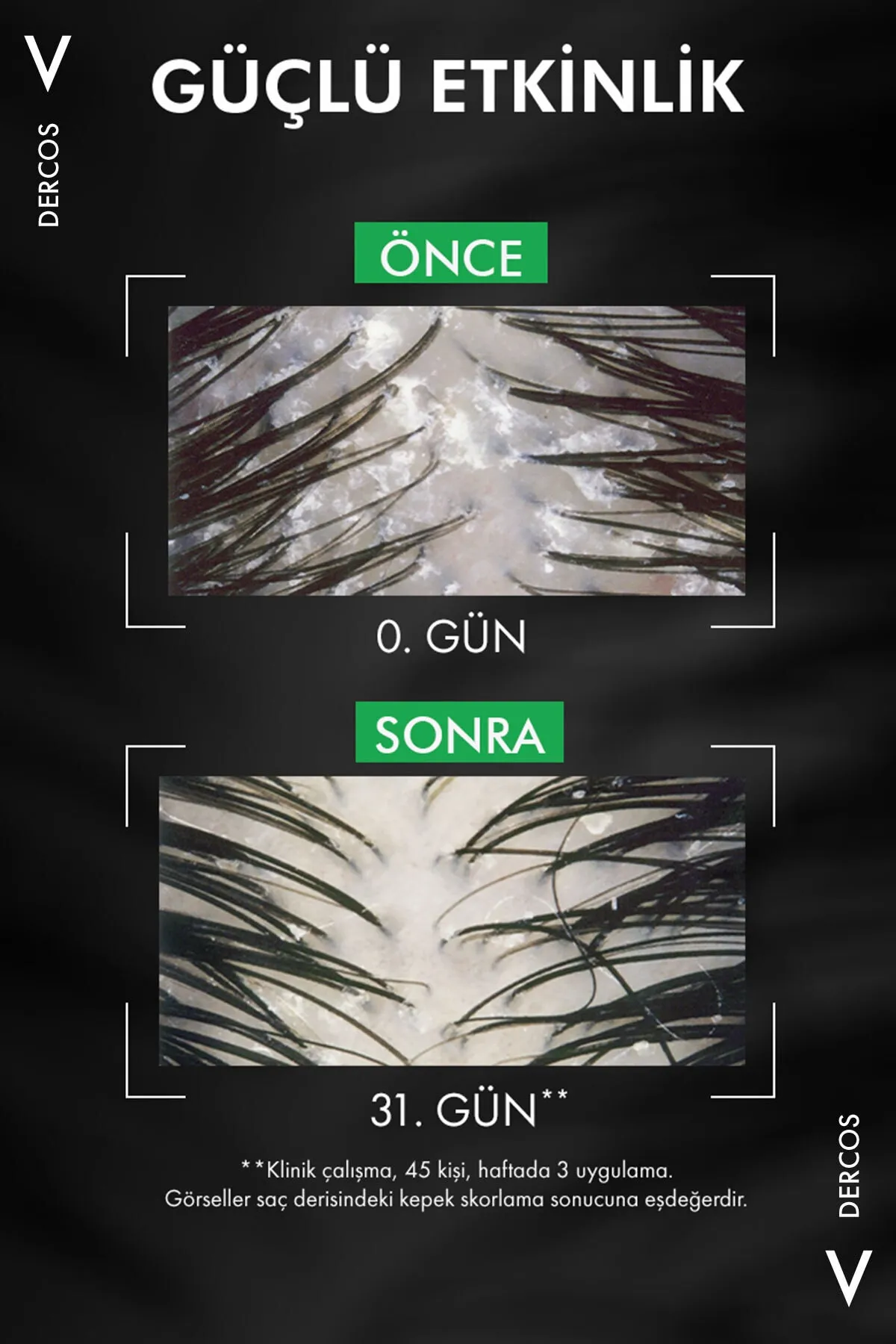 Vichy Dercos Anti-Dandruff Şampuan Kepek Karşıtı Normal ve Yağlı Saçlar İçin 390 ml