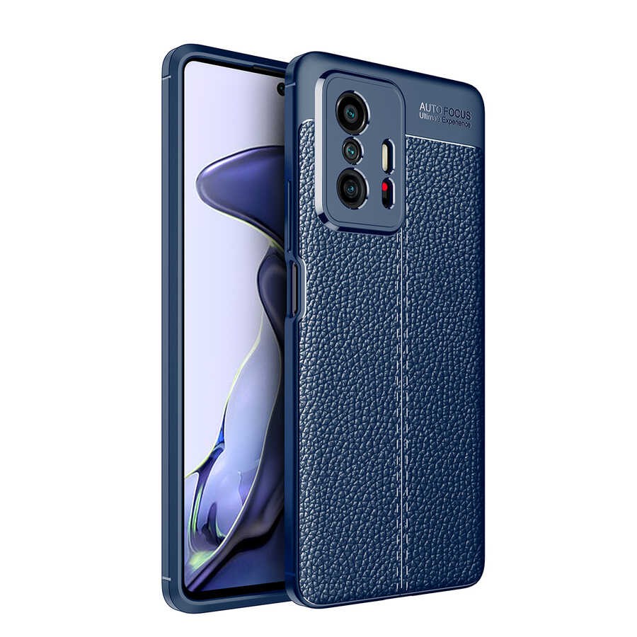 Xiaomi Mi 11T 5G Kılıf Zore Niss Silikon Kılıf