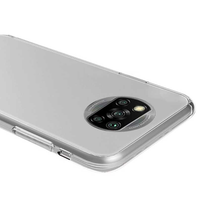 Xiaomi Poco X3 Kılıf Zore Enjoy Kılıf