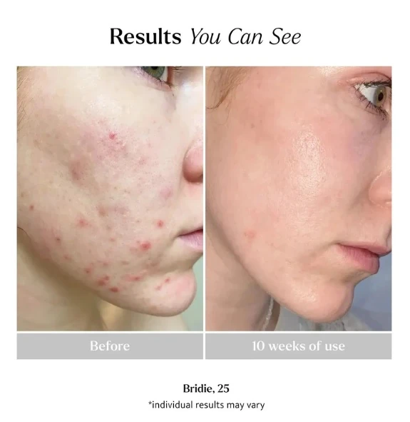 LEMON & BEAKER Aydınlatıcı Yüz Bakım Maskesi