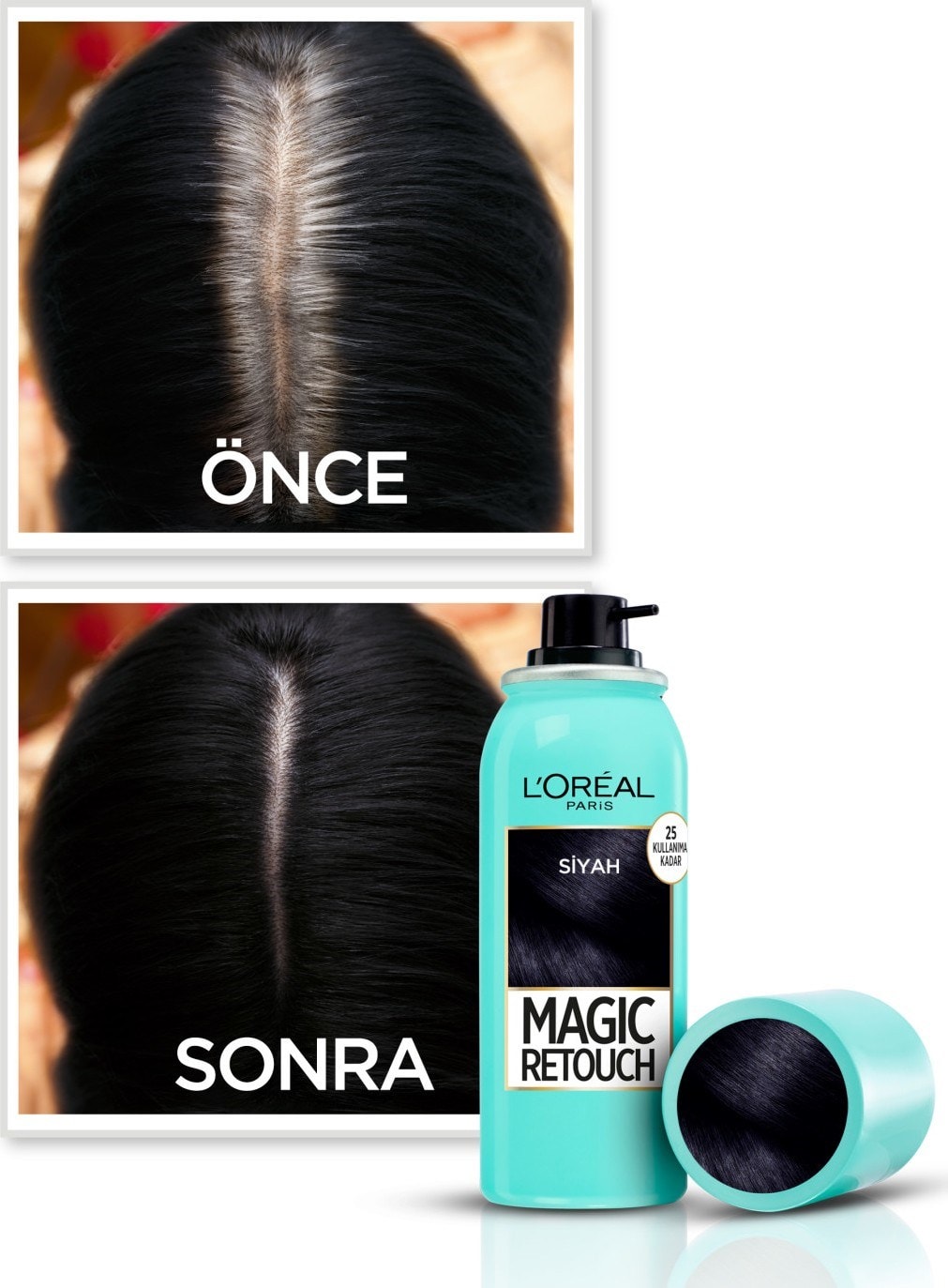 L'Oréal Paris Magic Retouch Beyaz Dipleri Kapatıcı Sprey - Siyah