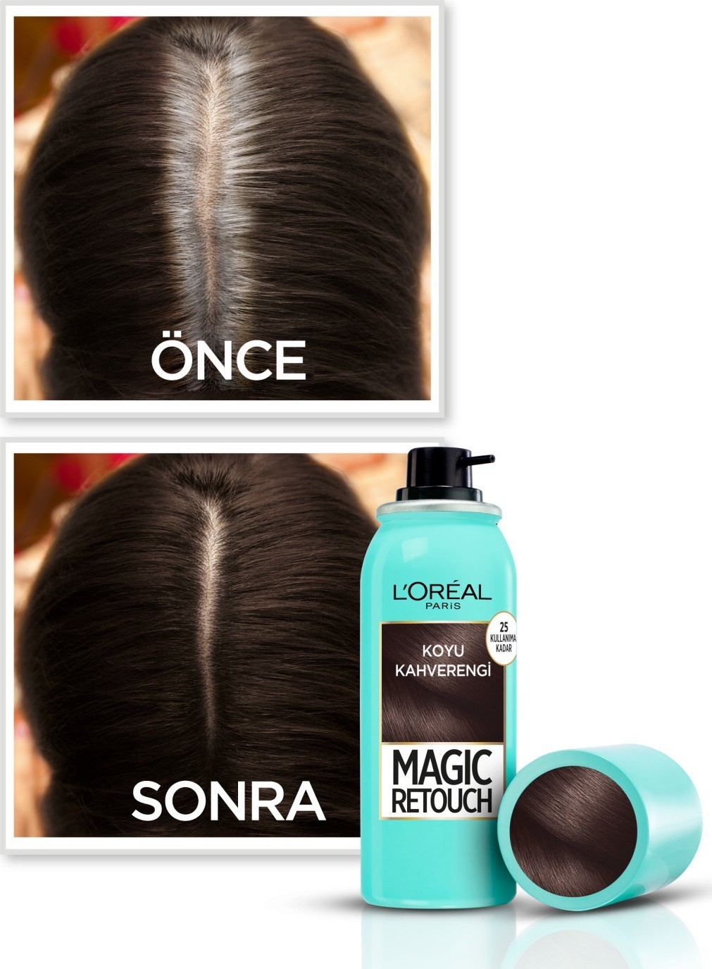 L'Oréal Paris Magic Retouch Beyaz Dipleri Kapatıcı Sprey - Koyu Kahverengi