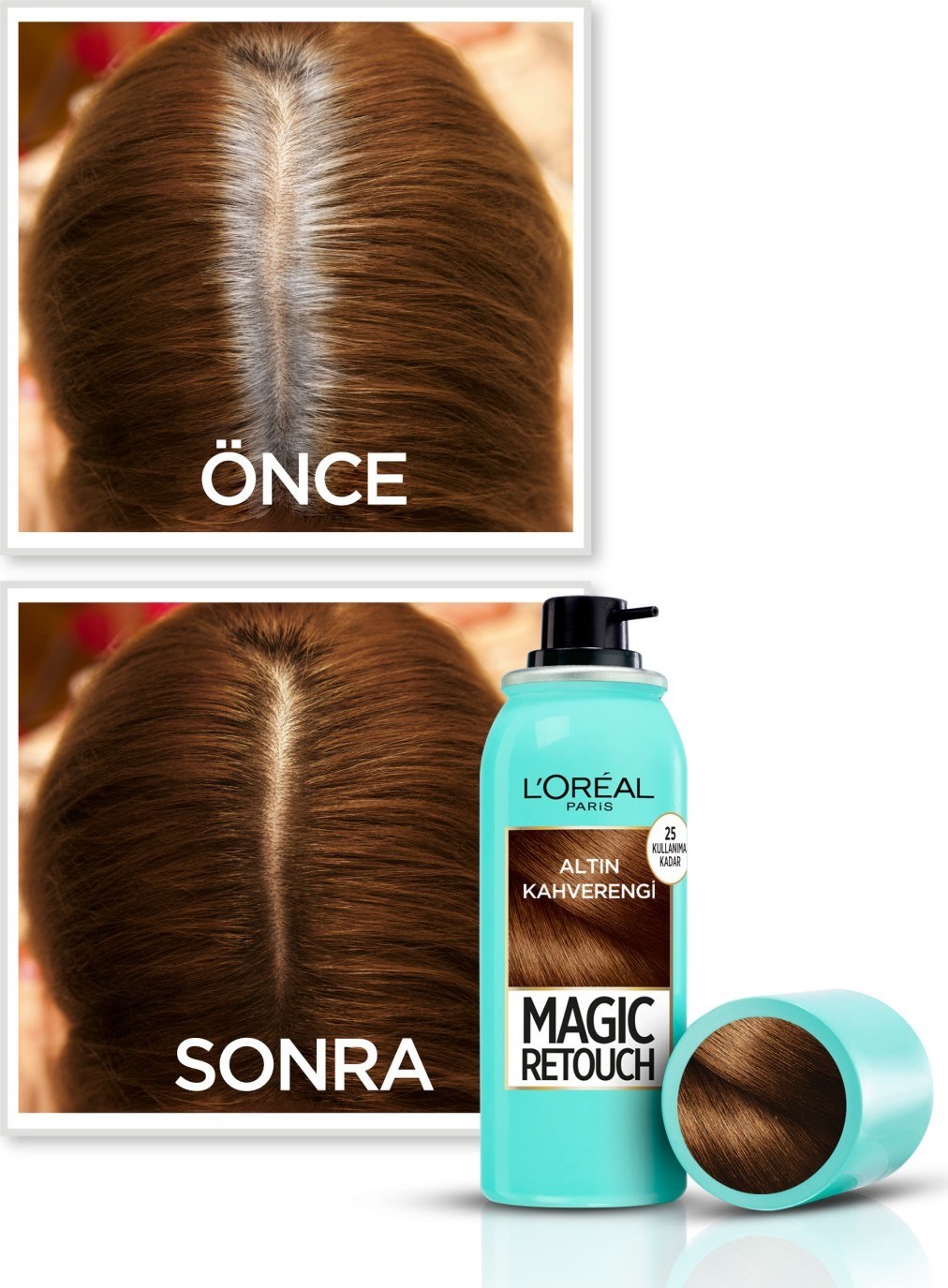 L'Oréal Paris Magic Retouch Beyaz Dipleri Kapatıcı Sprey - Altın Kahverengi