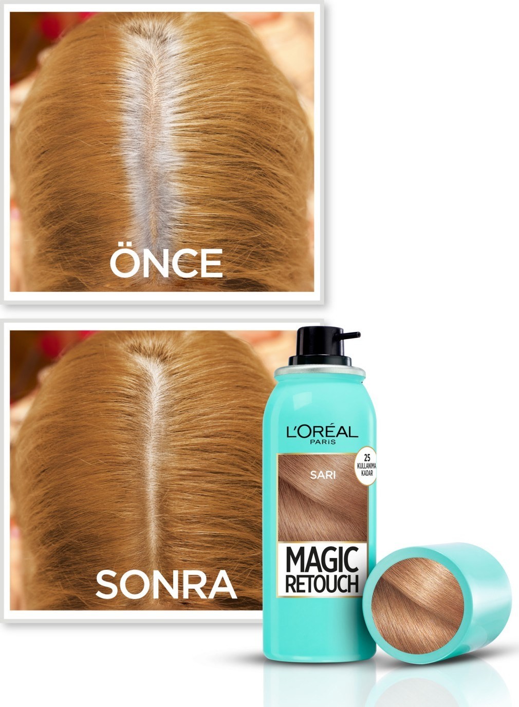 L'Oréal Paris Magic Retouch Beyaz Dipleri Kapatıcı Sprey - Sarı