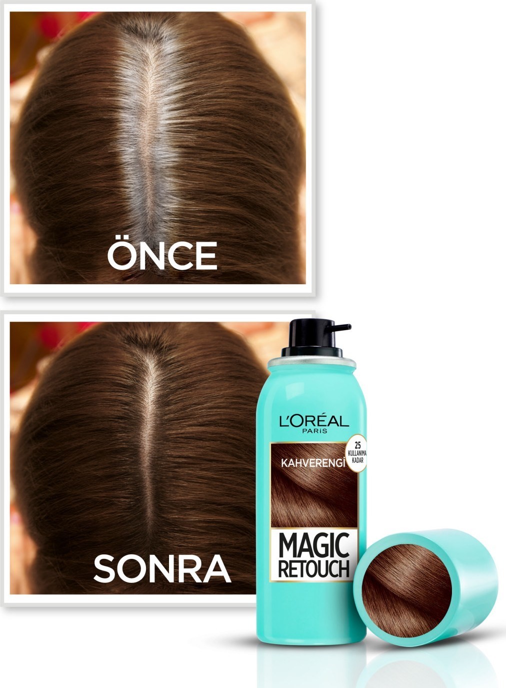 L'Oréal Paris Magic Retouch Beyaz Dipleri Kapatıcı Sprey - Kahverengi